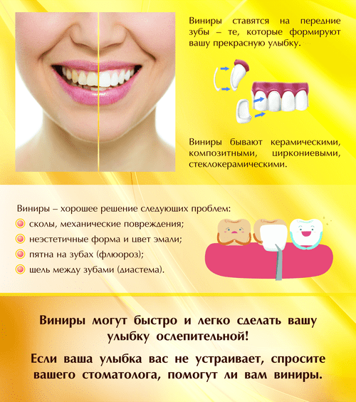 Виниры помогают решить эстетические проблемы
